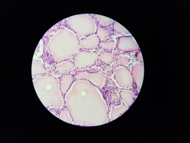 Parathyroid Thyroid Slides - Parathyroid_Thyroid 008 400X